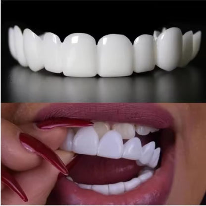 SnapBright™ Snap-On Veneers